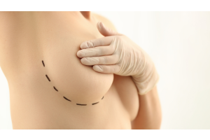 POST-BREAST SURGERY CREAM 